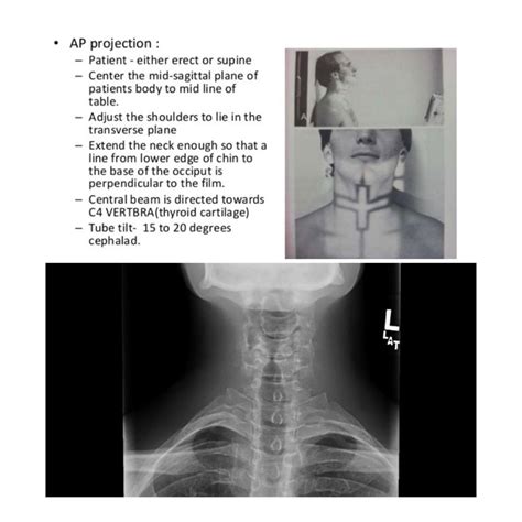soft tissue x ray technique.